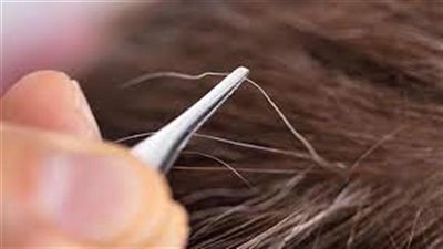 معلومة دينية: لماذا نهانها النبي عليه الصلاة والسلام عن نتف الشيب مفاجأة يكشفها العلم الحديث 