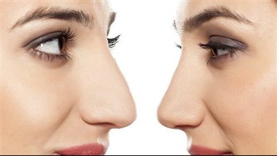 وصفات منزلية وطرق طبيعية لتصغر الأنف 