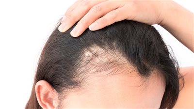 مكون متوفر في كل منزل لإنبات الشعر و توقف تساقطه