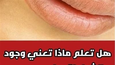 هل تعلم ماذا تعني وجود الشامات علي جسم الانسان لن تصدق ذلك ابدا .. 